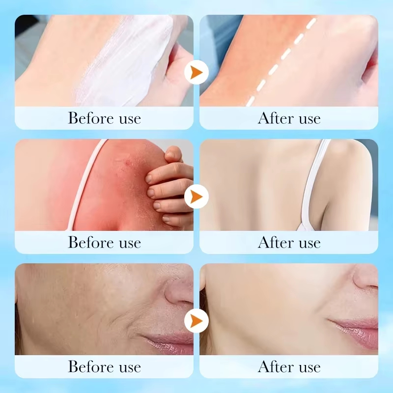 Crème solaire coréenne SKIN100 - Skincare Skin 1004 avis et prix