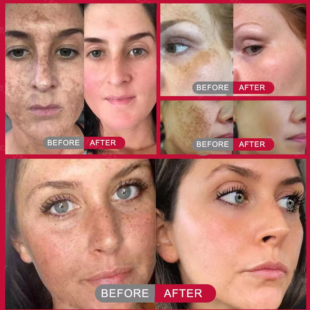 Crème éclaircissante puissante - Skincare Vitamin C avis et prix